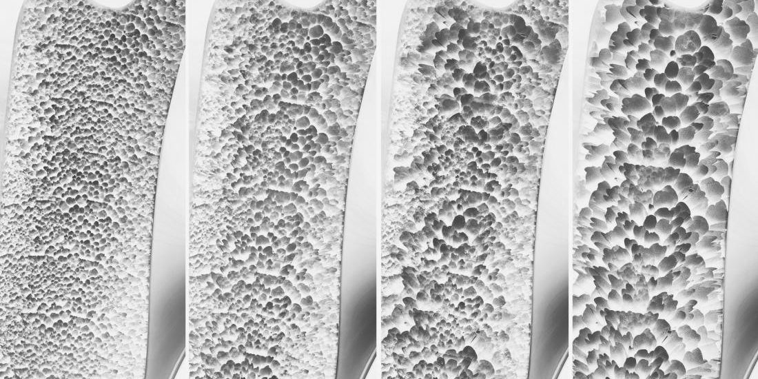 osteoporosis-causing-deterioration-inside-bone